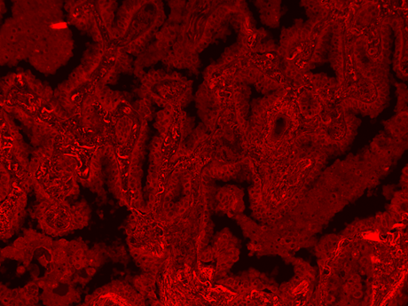 Formalin-fixed, paraffin-embedded (FFPE) human lung tissue was labeled with anti-EpCAM mouse mAb followed by HRP-labeled goat anti-mouse IgG (Cat No. 16728). The fluorescence signal was developed using mFluor™ Blue 630 styramide and detected with a Cy3 filter set.
