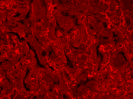 Formalin-fixed, paraffin-embedded (FFPE) human lung tissue was labeled with anti-EpCAM mouse mAb followed by HRP-labeled goat anti-mouse IgG (Cat No. 16728). The fluorescence signal was developed using mFluor™ Blue 660 styramide and detected with a Cy3 filter set.
