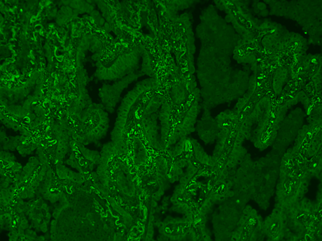 Formalin-fixed, paraffin-embedded (FFPE) human lung tissue was labeled with anti-EpCAM mouse mAb followed by HRP-labeled goat anti-mouse IgG (Cat No. 16728). The fluorescence signal was developed using mFluor™ Red 780 styramide (pseudo color: green) and detected with a Cy5 filter set.