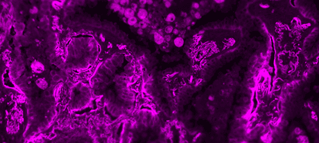 Formalin-fixed, paraffin-embedded (FFPE) human lung tissue was labeled with anti-EpCAM mouse mAb followed by HRP-labeled goat anti-mouse IgG (Cat No. 16728). The fluorescence signal was developed using mFluor™ Violet 540 styramide and detected with a Violet filter set.