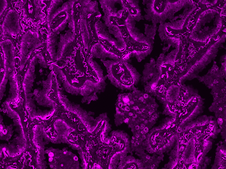 Formalin-fixed, paraffin-embedded (FFPE) human lung tissue was labeled with anti-EpCAM mouse mAb followed by HRP-labeled goat anti-mouse IgG (Cat No. 16728). The fluorescence signal was developed using mFluor™ Violet 545 styramide and detected with a Violet filter set.