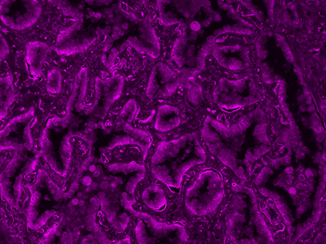 Formalin-fixed, paraffin-embedded (FFPE) human lung tissue was labeled with anti-EpCAM mouse mAb followed by HRP-labeled goat anti-mouse IgG (Cat No. 16728). The fluorescence signal was developed using mFluor™ Violet 610 styramide and detected with a Violet filter set.