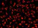 Image of HeLa cells stained with MitoLite™ Deep Red FX660 in a Costar black wall/clear bottom 96-well plate.