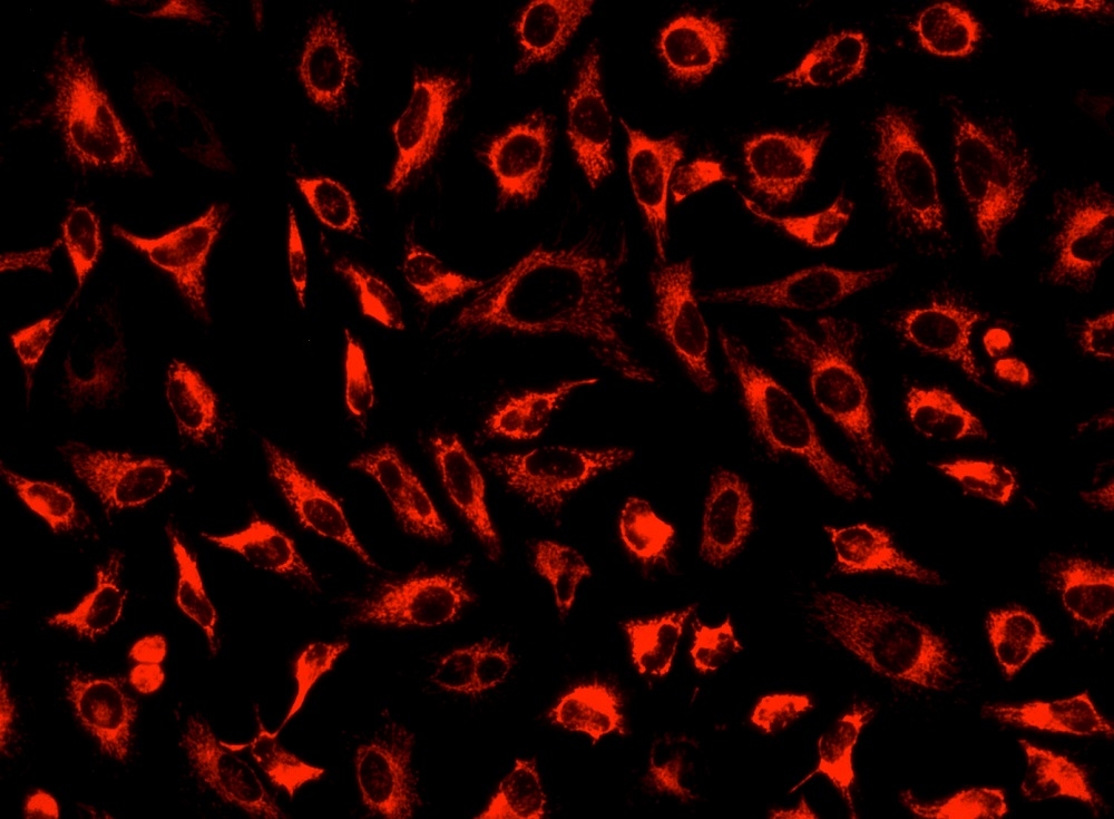 Image of HeLa cells stained with MitoLite™ Deep Red FX660 in a Costar black wall/clear bottom 96-well plate.