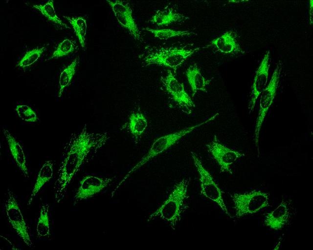 Fluorescence image of HeLa cells stained with MitoLite&trade; Green EX488 in a Costar black-wall/clear bottom 96-well plate.