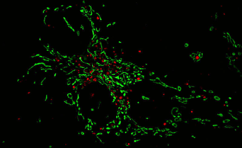 Time-lapse super-resolution fluorescence imaging of live COS-7 cells stained with MitoLite™ Green FM and LysoBrite™ Red. Live COS-7 cells were labeled with MitoLite™ Green FM (Cat. #22695) for mitochondrial staining and LysoBrite™ Red (Cat. #22645) for lysosomal staining. Images were acquired using the CSR Biotech MI-SIM super-resolution microscopy system and reconstructed using standard Wiener reconstruction. The merged sequence shows mitochondria in green and lysosomes in red.
Data credit: Data was generated by CSR Biotech using their MI-SIM microscopy system with MitoLite™ Green FM and LysoBrite™ Red from AAT Bioquest.