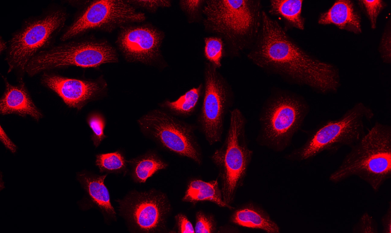 Fluorescence image of HeLa cells stained with MitoLite™ Orange FX570 using fluorescence microscope with a Cy3 filter set. The cells were fixed in 4% formaldehyde, permeabilised with 0.2% Triton X-100 followed by staining with MitoLite™ Orange FX570 (#22676) and counter staining with Nuclear Blue™ DCS1 (#17548). The image was acquired with a fluorescence microscope using Cy3-TRITC and DAPI filters respectively.