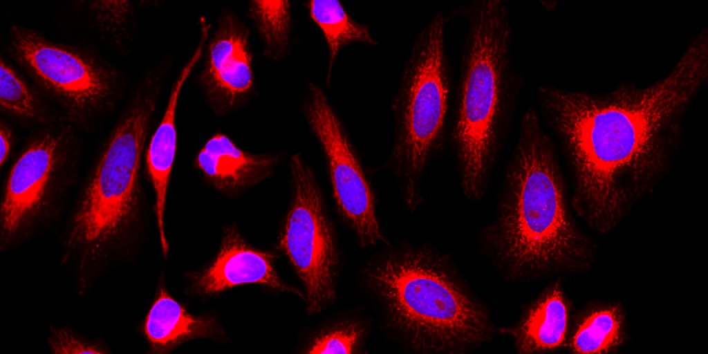 Fluorescence image of HeLa cells stained with MitoLite™ Orange FX660 using fluorescence microscope with a Cy3 filter set. The cells were fixed in 4% formaldehyde, permeabilised with 0.2% Triton X-100 followed by staining with MitoLite™ Red FX600 (#22677) and counter staining with Nuclear Blue™ DCS1 (#17548). The image was acquired with a fluorescence microscope using Cy3-TRITC and DAPI filters, respectively.