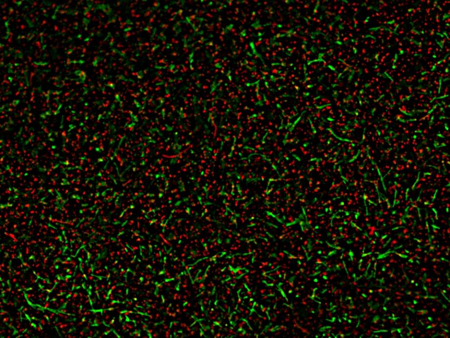 A mixed population of live and dead <em>Bacillus subtilis </em>was stained with MycoLight™ Fluorescence Live/Dead Bacterial Imaging Kit. Live bacteria with active intracellular esterase showed green fluorescence, while 70% alcohol-killed dead bacteria with compromised membranes showed red fluorescence.