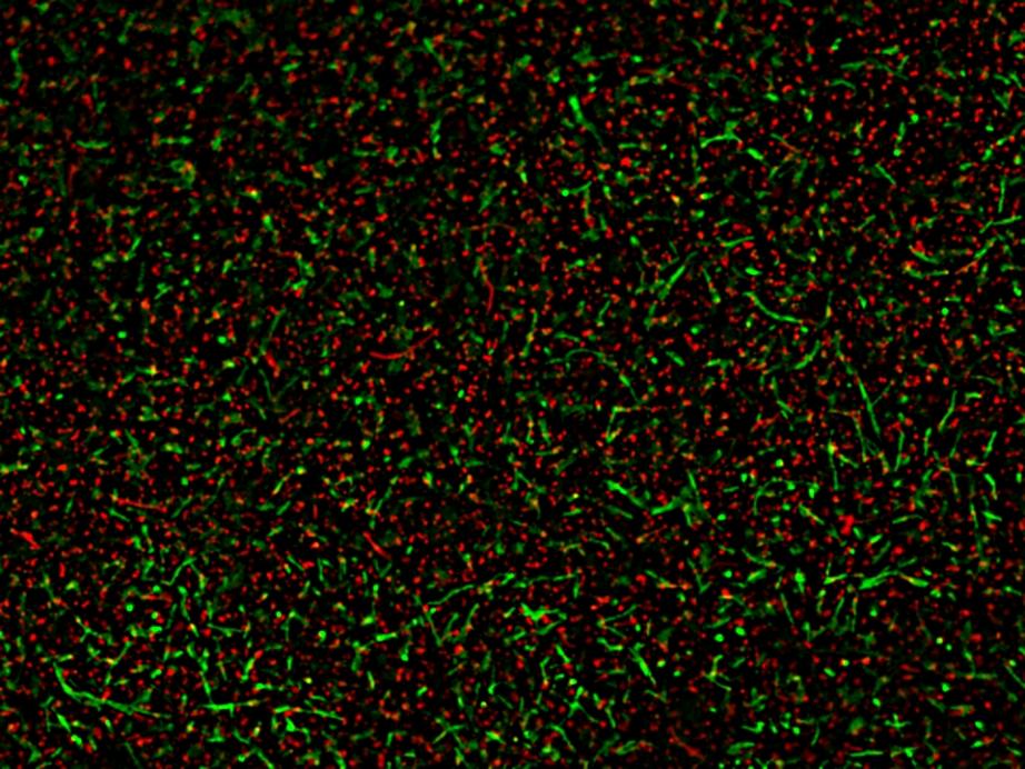 A mixed population of live and dead <em>Bacillus subtilis </em>was stained with MycoLight&trade; Fluorescence Live/Dead Bacterial Imaging Kit. Live bacteria with active intracellular esterase showed green fluorescence, while 70% alcohol-killed dead bacteria with compromised membranes showed red fluorescence.