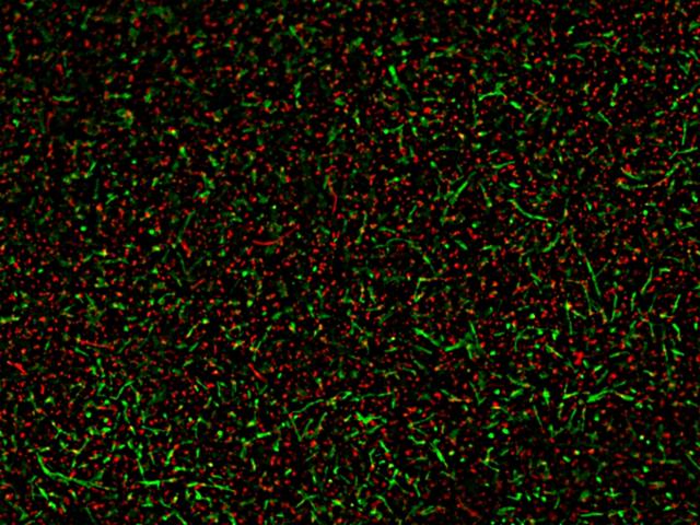 A mixed population of live and dead <em>Bacillus subtilis </em>was stained with MycoLight&trade; Fluorescence Live/Dead Bacterial Imaging Kit. Live bacteria with active intracellular esterase showed green fluorescence, while 70% alcohol-killed dead bacteria with compromised membranes showed red fluorescence.