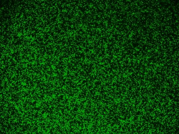 <em>E.Coli</em> were stained with 5 uM of MycoLight&trade; Green JJ98 for 30 minutes and imaged with FITC channel.