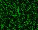<em>E.Coli</em> were stained with 5 uM of MycoLight&trade; Green JJ98 for 30 minutes and imaged with FITC channel.