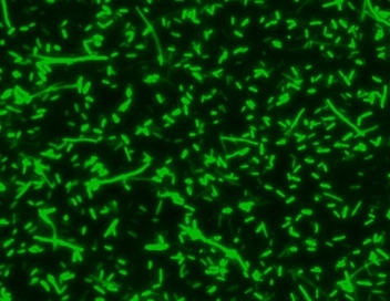 <em>E.Coli</em> were stained with 5 uM of MycoLight™ Green JJ99 for 30 minutes and imaged with FITC channel.