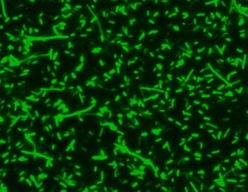 <em>E.Coli</em> were stained with 5 uM of MycoLight&trade; Green JJ99 for 30 minutes and imaged with FITC channel.