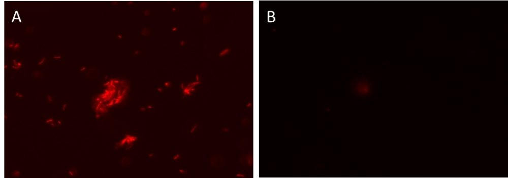 <em>Bacillus subtilis (Gram-positive) </em>(A) and <em>Escherichia coli</em> <em>(Gram-negative)</em> (B) was stained with MycoLight™ Rapid Fluorescence Gram-Positive Bacteria Staining Kit.