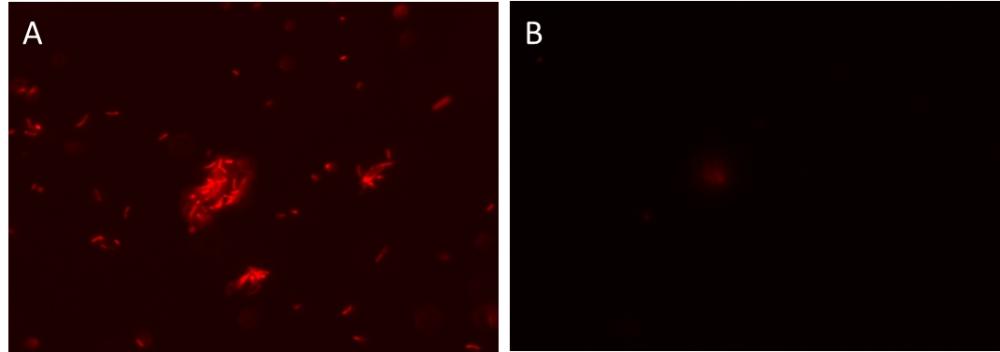 <em>Bacillus subtilis (Gram-positive) </em>(A) and <em>Escherichia coli</em> <em>(Gram-negative)</em> (B) was stained with MycoLight&trade; Rapid Fluorescence Gram-Positive Bacteria Staining Kit.