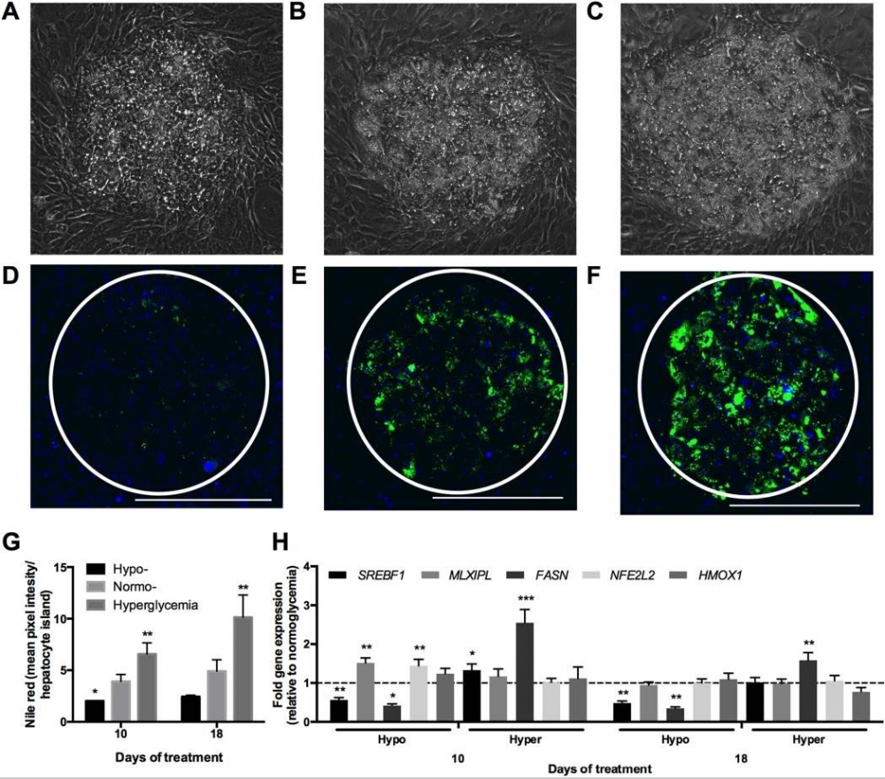 Glucose-induced accumulation of neutral lipids in MPCCs after 10 days of treatment. Phase contrast images of MPCCs in hypo- (A), normo- (B) and hyperglycemic (C) culture medium after 10 days of treatment. Nile red (neutral lipids) staining of MPCCs in hypo- (D), normo- (E) and hyperglycemic (F) culture medium after 10 days of treatment. Circles highlight hepatocyte island location and scale bar is 400 µm. Source: <strong>Long-term exposure to abnormal glucose levels alters drug metabolism pathways and insulin sensitivity in primary human hepatocytes </strong>by Davidson et al., <em>Scientific Reports</em>, June 2016.