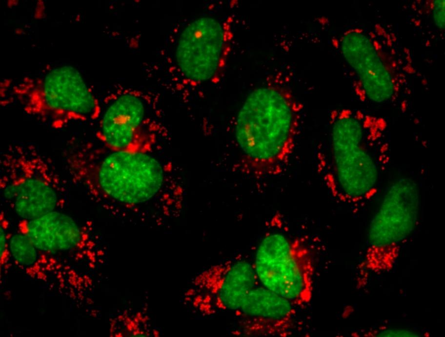 Fluorescence images of oleic acid treated HeLa cells stained with Cell Navigator® Lipid Droplets Fluorescence Assay Kit (Cat#22735) and Nuclear Green™ LCS1 (Cat#17540).