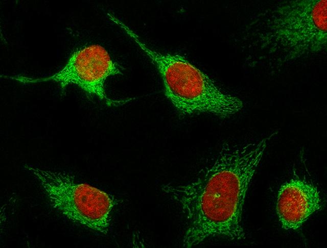 Fluorescence images of HeLa cells stained with MitoLite&trade; Green FM using fluorescence microscope with a FITC filter set (Green). Live cells were co-stained with nuclei stain Nuclear Red&trade; LCS1 Cat. 17542 (Red).
