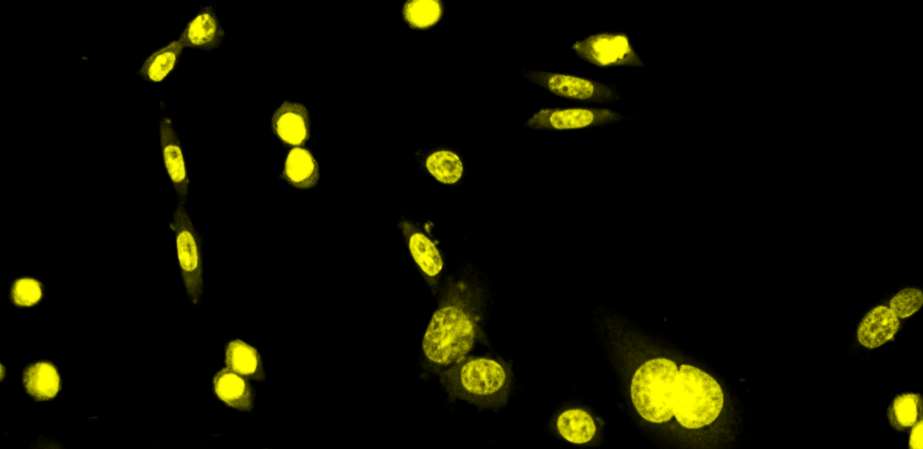 Fixed CPA 47 cells stained with MitoLite™ Blue FX490 (Cat. #22674), shown in blue, and counterstained with Nuclear Yellow (Cat. #17539), pseudocolored magenta. The image was acquired using a fluoresence microscope.