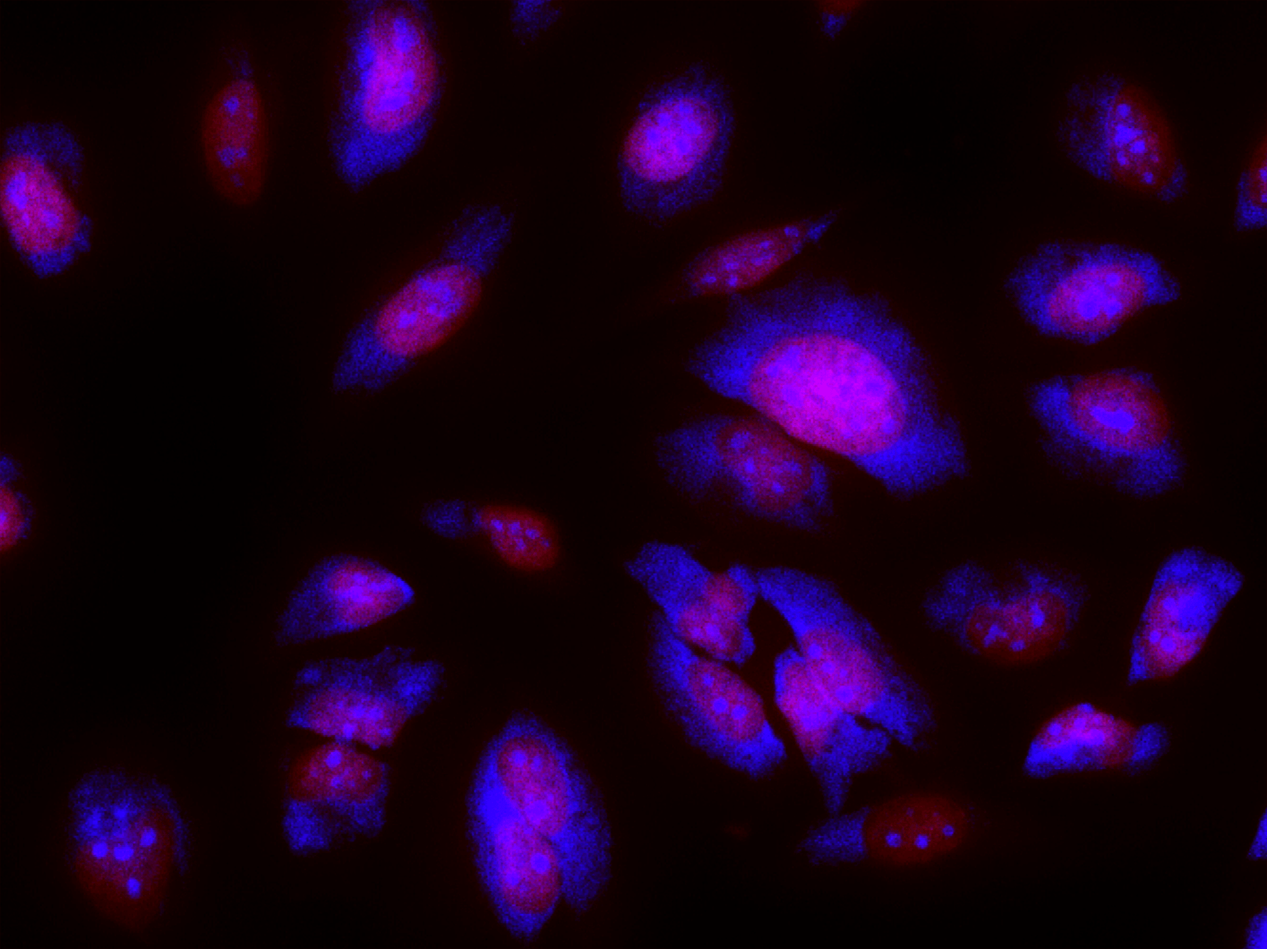 Fluorescence image of fixed HeLa cells stained with Nucleolus Blue™ DCS1 (Cat# 17680) and Nuclear Red™ LCS1 (Cat# 17542).