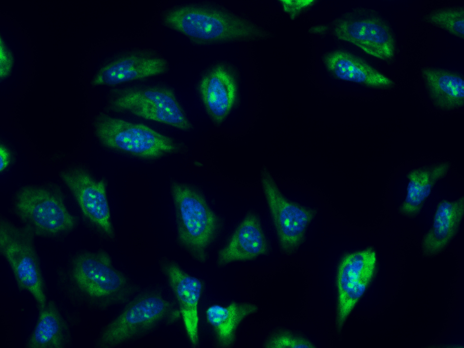 Fluorescence image of fixed HeLa cells stained with Nucleolus Green™ LCS1(Cat# 17682) and Nuclear Blue™ DCS1 (Cat# 17548).