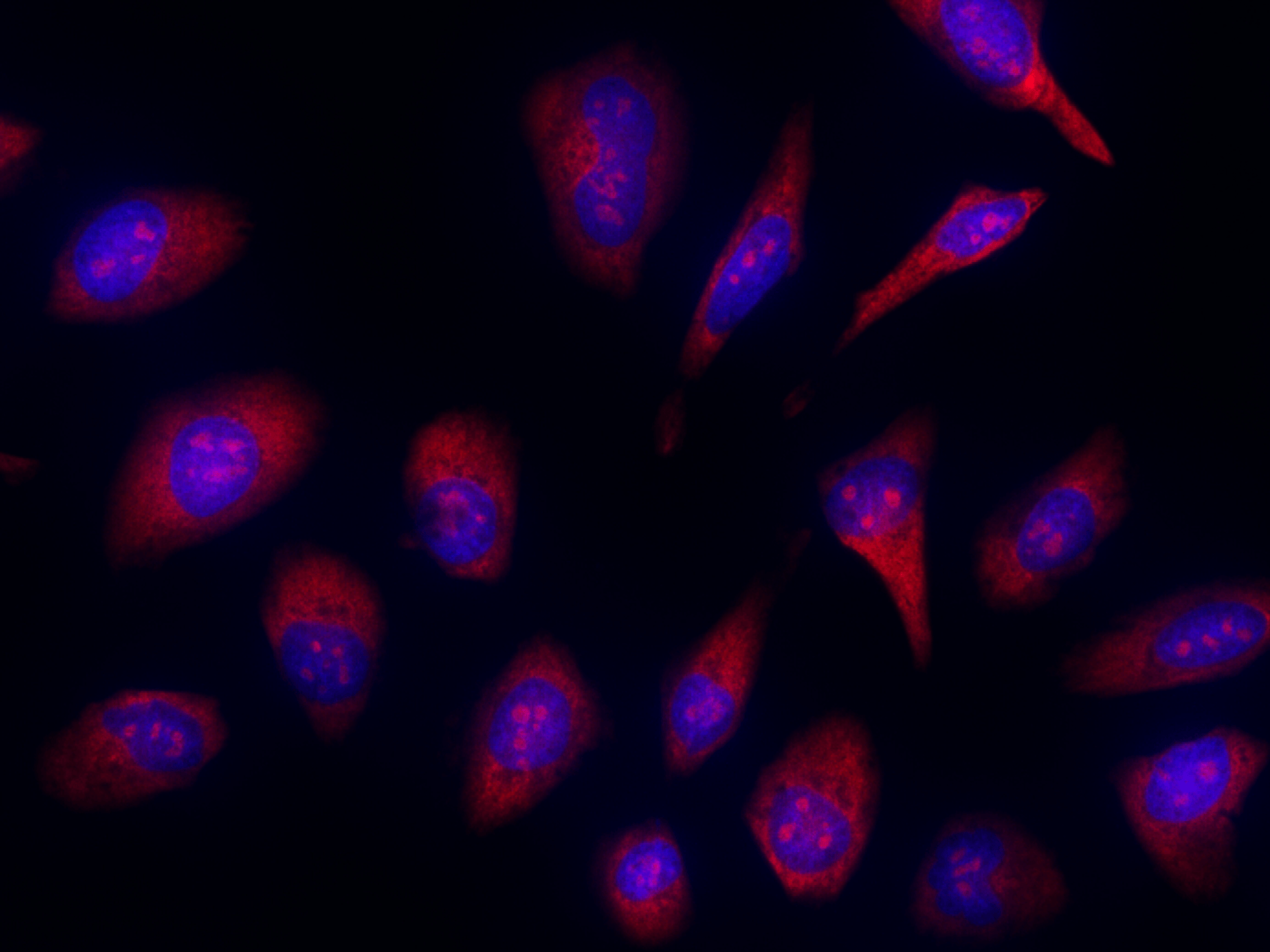 Fluorescence image of Fixed HeLa cells stained with Nucleolus Red™ DCS1 (Cat# 17682) and Nuclear Blue™ DCS1 (Cat# 17548)
