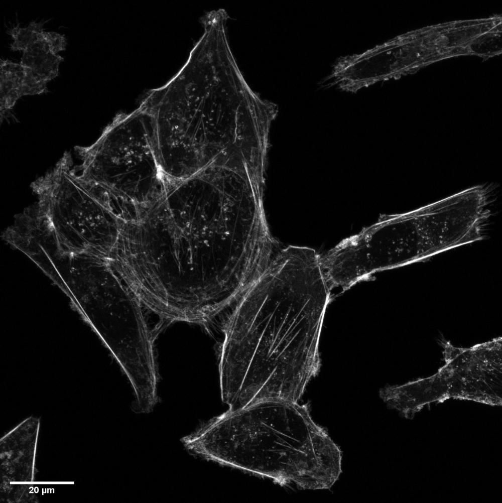 <strong>Figure 2.</strong> MDA-MB-231 breast cancer cell grew for 24 h. Cells were stained with Phalloidin-iFluor 488 Conjugate (ATT Bioquest) following manufacturer&rsquo;s instruction. Images were acquired with a 63x/1.4NA objective on a Zeiss laser-scanning confocal microscope by the Advanced Bio-Imaging Facility (ABIF) at McGill.&nbsp;Displayed is the Max Intensity Projection of 19 images with 0.2 um spacing in Z.