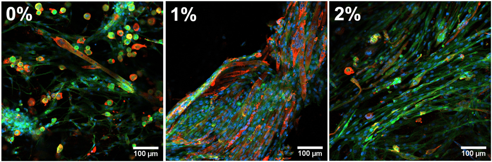 Conditioning of GelMA-AlgMA bioinks for skeletal muscle tissue engineering. Modulation of GelMA-AlgMA bioink mechanical properties of GelMA with 0 %,1 % and 2 % AlgMA (n = 9). Confocal images of C2C12 cells after 14 days of differentiation with stained MHC (red), F-actin (green) and nuclei (blue). Actin was stained with Phalloidin-iFluor 488. Scale bar = 100 μm. Source: <b>3D bioprinted functional skeletal muscle models have potential applications for studies of muscle wasting in cancer cachexia</b> by Andrea García-Lizarribar et.al., <em>Biomaterials Advances</em> April 2023.