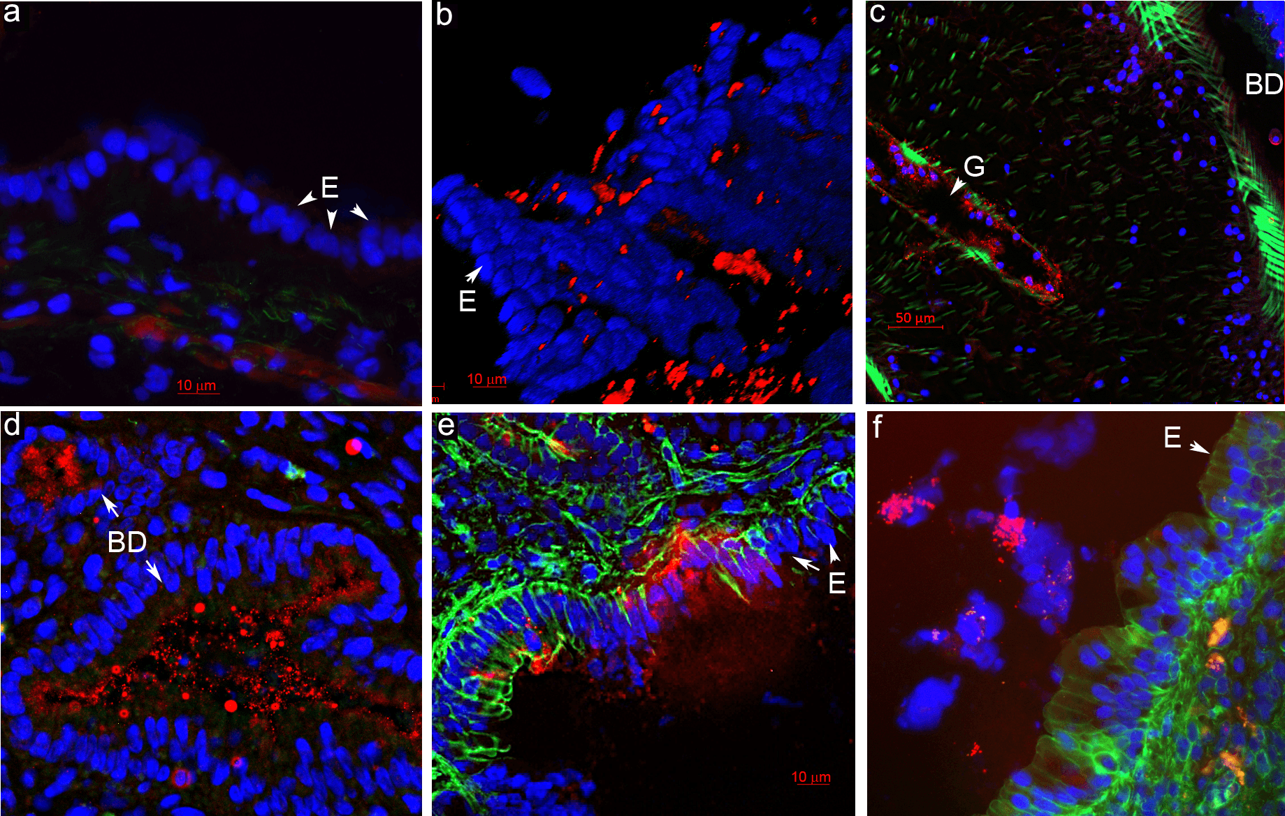 Enterobacteriaceae (Lipid A) in the liver of the uninfected and the liver fluke-infected hamsters. a. An uninfected hamster. b. 3D reconstruction of the internal surface of a bile duct after confocal microscopy reveals the presence of Enterobacteriaceae Lipid A. c. Bacteria inside the gut of the O. viverrini parasite. d. Enterobacteriaceae presence inside small bile ducts of an O. viverrini–infected hamster. e. Penetration of bacteria through the injured epithelium in the bile duct of an O. felineus–infected hamster. f. A multilayered epithelium in the bile duct of a C. sinensis–infected hamster. E: epithelial cells; BD: bile duct; red color: Lipid A of Enterobacteriaceae; green color: actin filaments (Phalloidin 488 staining); blue color: nuclei (DAPI staining). E: epithelium of bile duct; BD: bile duct; G: gut of a worm. Source: <b><em>Opisthorchis viverrini</em>, <em>Clonorchis sinensis</em> and <em>Opisthorchis felineus</em> liver flukes affect mammalian host microbiome in a species-specific manner</b> by Pakharukova <em>et. al.</em>, <em>PLoS Negl Trop Dis</em>. Feb. 2023.