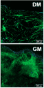 Myogenic differentiation in 3D bioprinted models. Immunostaining of C2C12 cells after 15 days in bioprinted rings cultured in differentiation medium (DM) and growth medium (GM). Nuclei are stained in blue and green corresponds to F-actin (n = 4). Scale bar = 200 μm. Actin was stained with Phalloidin-iFluor 488. 
Source: <b>3D bioprinted functional skeletal muscle models have potential applications for studies of muscle wasting in cancer cachexia</b> by Andrea García-Lizarribar et.al., <em>Biomaterials Advances</em> April 2023.