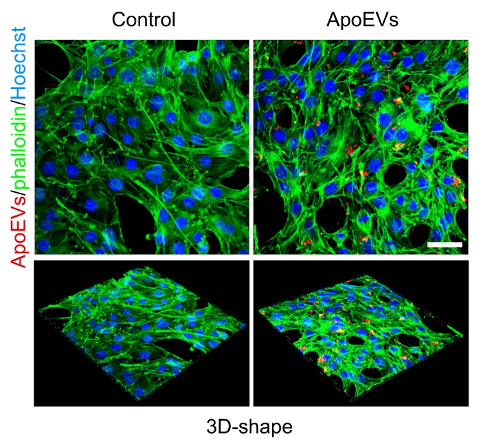 MSCs-ApoEVs promote fusion and apoptosis ratio of C2C12 myoblasts in vitro. The representative fluorescence images of C2C12 myoblasts after MSCs-ApoEVs treatment, MSCs-ApoEVs were pre-stained by PKH26, scale bar indicates 50 μm. Source: <b>MSCs-derived apoptotic extracellular vesicles promote muscle regeneration by inducing Pannexin 1 channel-dependent creatine release by myoblasts</b> by Qingyuan Ye, Xinyu Qiu, Jinjin Wang, Boya Xu, Yuting Su, Chenxi Zheng, Linyuan Gui, Lu Yu, Huijuan Kuang, Huan Liu, Xiaoning He, Zhiwei Ma, Qintao Wang & Yan Jin. <em>International Journal of Oral Science</em>, January 2023.