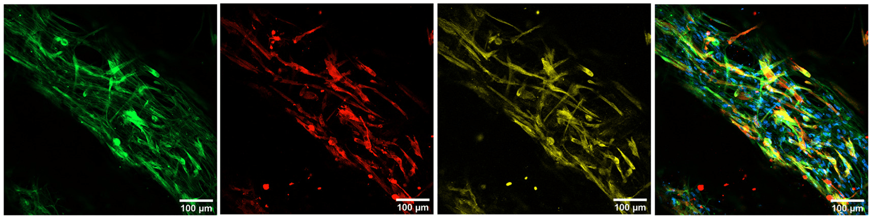 Bioprinted human muscle models. Immunostaining of bioprinted rings cultured for 14 days in GM showing Human Skeletal Muscle Myoblasts (HSMM) fibers expressing MHC (red) and α-actinin (yellow). F-actin (green) and nuclei (blue) were also stained. Scale bar = 100 μm. Data is presented as mean ± SD, Unpaired t-test *p-value <0.05, **p-value <0.005 and ***p-value <0.0005. Actin was stained with Phalloidin-iFluor 488. Source: <b>3D bioprinted functional skeletal muscle models have potential applications for studies of muscle wasting in cancer cachexia</b> by Andrea García-Lizarribar et.al., <em>Biomaterials Advances</em> April 2023.