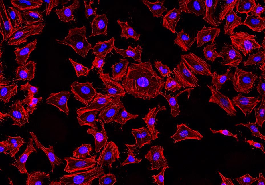 <p>Fluorescence images of HeLa cells stained with Phalloidin-iFluor® 514 Conjugate using fluorescence microscope with a TRITC filter set (Red). Fixed cells were counterstained with Nuclear Blue™ DCS1 (Cat#17548, Blue).</p>
