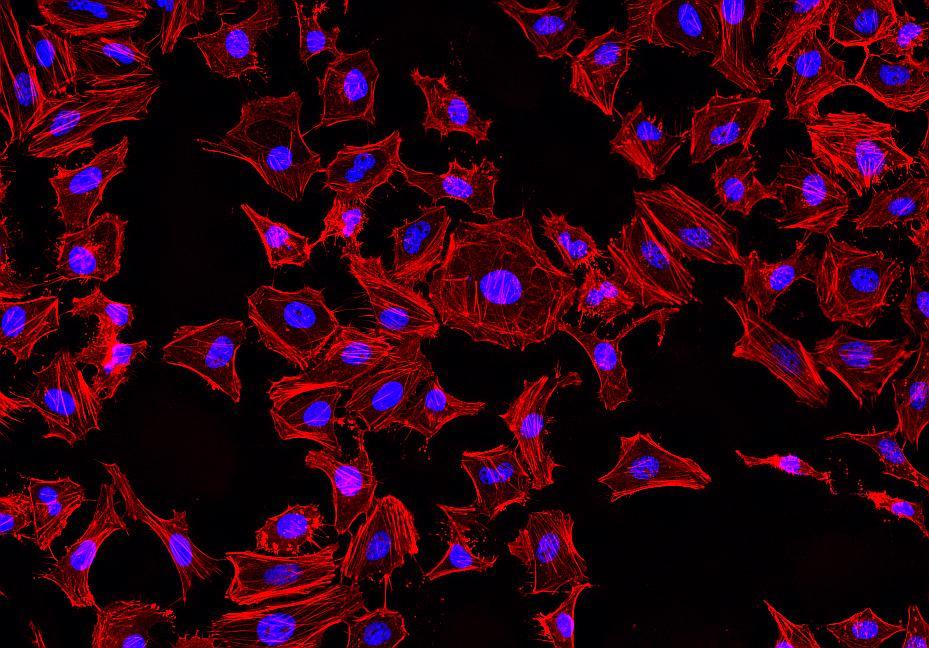 Fluorescence images of HeLa cells stained with Phalloidin-iFluor™ 514 Conjugate using fluorescence microscope with a TRITC filter set (Red). Fixed cells were counterstained with Nuclear Blue™ DCS1 (Cat#17548, Blue).