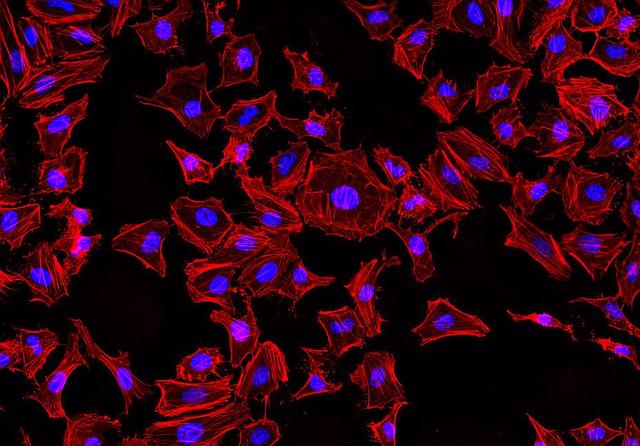 Fluorescence images of HeLa cells stained with Phalloidin-iFluor® 514 Conjugate using fluorescence microscope with a TRITC filter set (Red). Fixed cells were counterstained with Nuclear Blue™ DCS1 (Cat#17548, Blue).