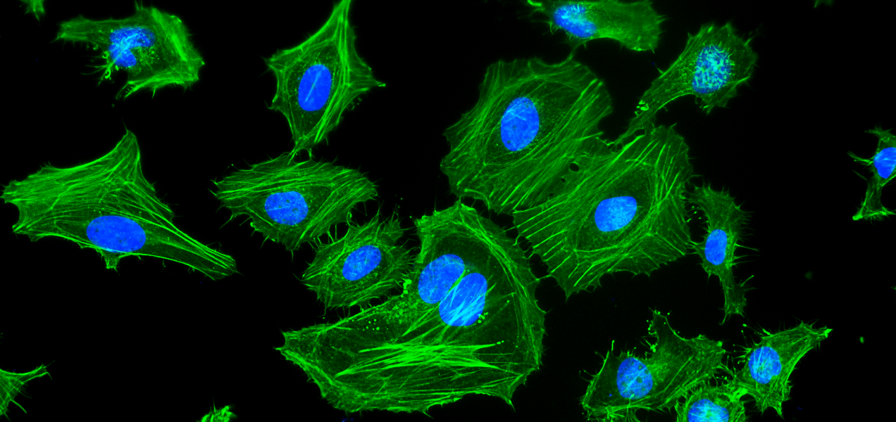 Fluorescence image of HeLa cells stained with Phalloidin-iFluor® 514 Conjugate. Fixed HeLa cells were stained with Phalloidin-iFluor® 514 Conjugate (Cat. #23116) for F-actin detection and counterstained with Hoechst 33342 (Cat. #17530) for nuclear staining. Images were acquired using FITC and DAPI filter sets and overlaid to show F-actin in green and nuclei in blue.