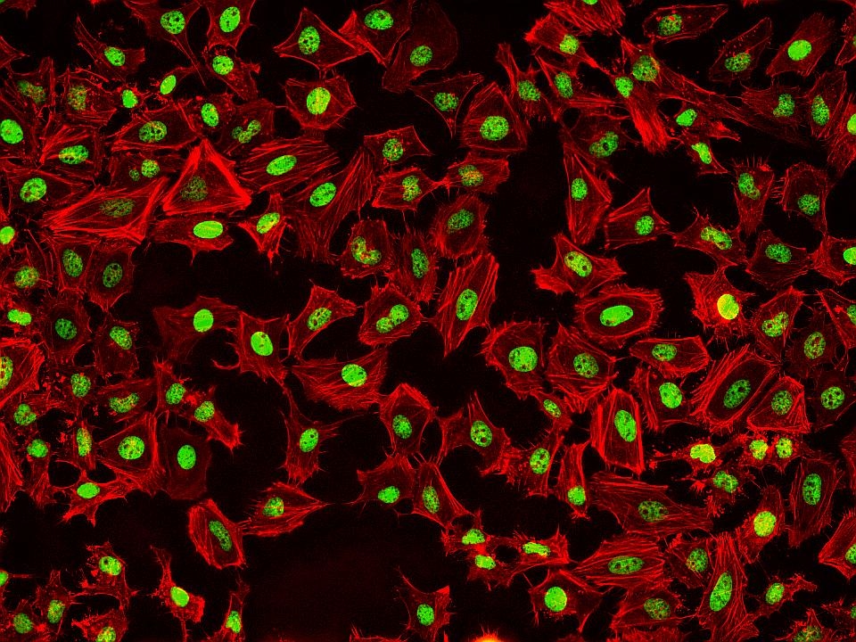 <p>Fluorescence images of HeLa cells stained with Phalloidin-iFluor® 532 Conjugate using fluorescence microscope with a TRITC filter set (Red). Fixed cells were counterstained with Nuclear Green™ DCS1 (Cat#17550, Green).</p>