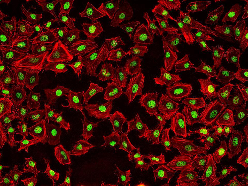 Fluorescence images of HeLa cells stained with Phalloidin-iFluor™ 532 Conjugate using fluorescence microscope with a TRITC filter set (Red). Fixed cells were counterstained with Nuclear Green™ DCS1 (Cat#17550, Green).
