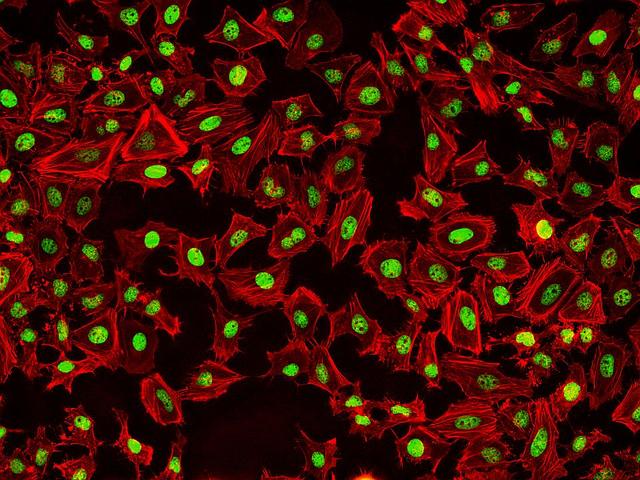 Fluorescence images of HeLa cells stained with Phalloidin-iFluor® 532 Conjugate using fluorescence microscope with a TRITC filter set (Red). Fixed cells were counterstained with Nuclear Green™ DCS1 (Cat#17550, Green).