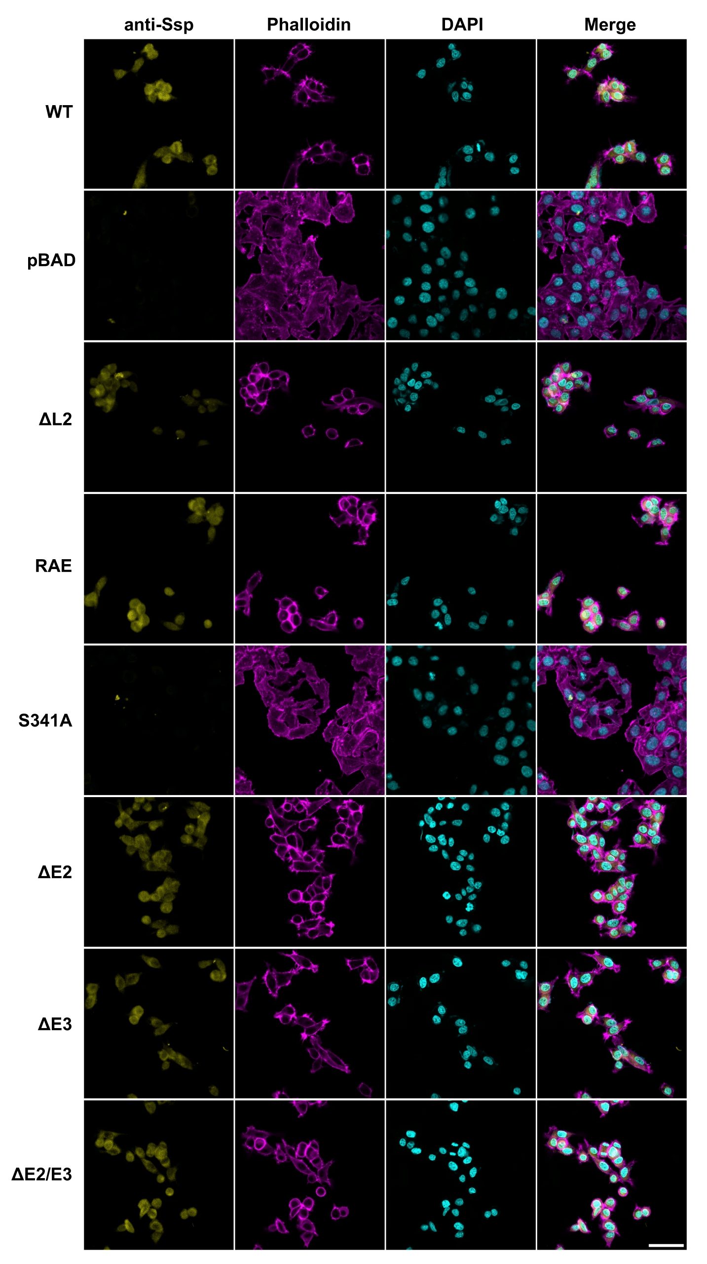 Confocal microscopy images of HEp-2 cells incubated with concentrated culture supernatants of Ssp variants (25 μg/mL) for 5 h. Ssp was visualised with anti-Ssp polyclonal antibody followed by Alexa Fluor Plus 647 conjugated secondary antibody (yellow), actin cytoskeleton was stained with iFluor 555 phalloidin (magenta) and nucleus stained with DAPI (cyan). Ssp variants include wildtype (WT), deletions of Loop 2 (ΔL2), deletion of active site protrusions E2 and E3 (ΔE2, ΔE3, ΔE2/ΔE3), and site-directed mutants of the active site Ser (S314A) and RGD motif (RAE). pBAD denotes vector only control. Images are representative of cells observed from at least three independent experiments. Scale bar represents 50 μm. Source: <b>Crystal structure of a subtilisin-like autotransporter passenger domain reveals insights into its cytotoxic function</b>. by Hor, <em>et. al.</em>., <em>Nature Communications</em>, March 2023.