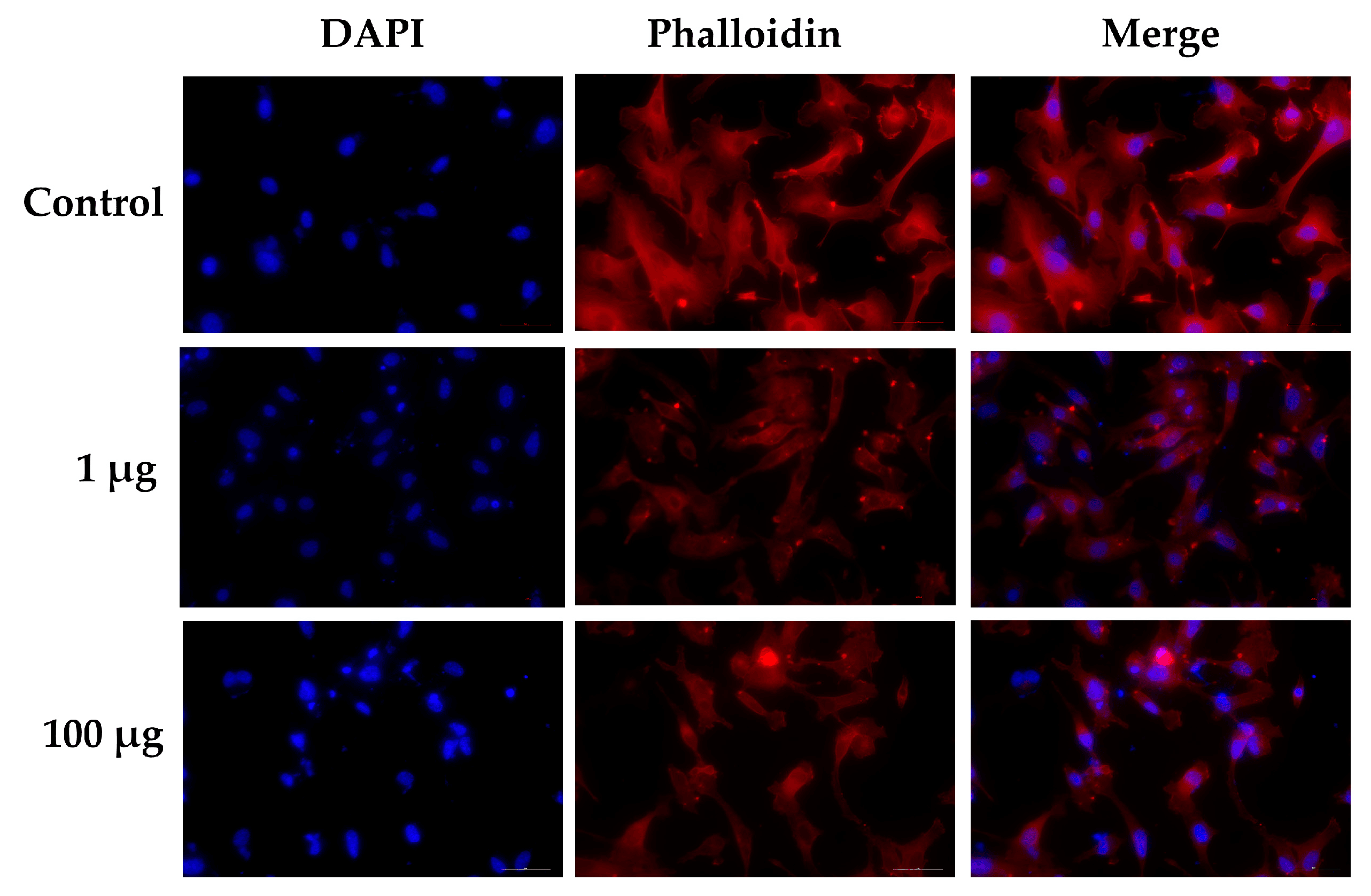 Effects of LPS on filamentous actin arrangement and apoptotic cell death. EA.hy926 cells were incubated with LPS as per the indicated concentrations for 48 h. The treated cell on cell culture slide chamber was stained using fluorescent-tagged phalloidin (Phalloidin-iFluor 555) to visualize the actin filament. Cell images were captured under a fluorescent microscope at 200× magnitude. Treated cells were stained using Annexin V and Dead Cell Reagent (7-AAD) and analyzed using the Muse™ Cell Analyzer. Source: <b>Proteomic Profiling of Early Secreted Proteins in Response to Lipopolysaccharide-Induced Vascular Endothelial Cell EA.hy926 Injury</b> by Songjang, W.; Paiyabhroma, N.; Jumroon, N.; Jiraviriyakul, A.; Nernpermpisooth, N.; Seenak, P.; Kumphune, S.; Thaisakun, S.; Phaonakrop, N.; Roytrakul, S.; <em>et. al. Biomedicines</em>. Nov. 2023