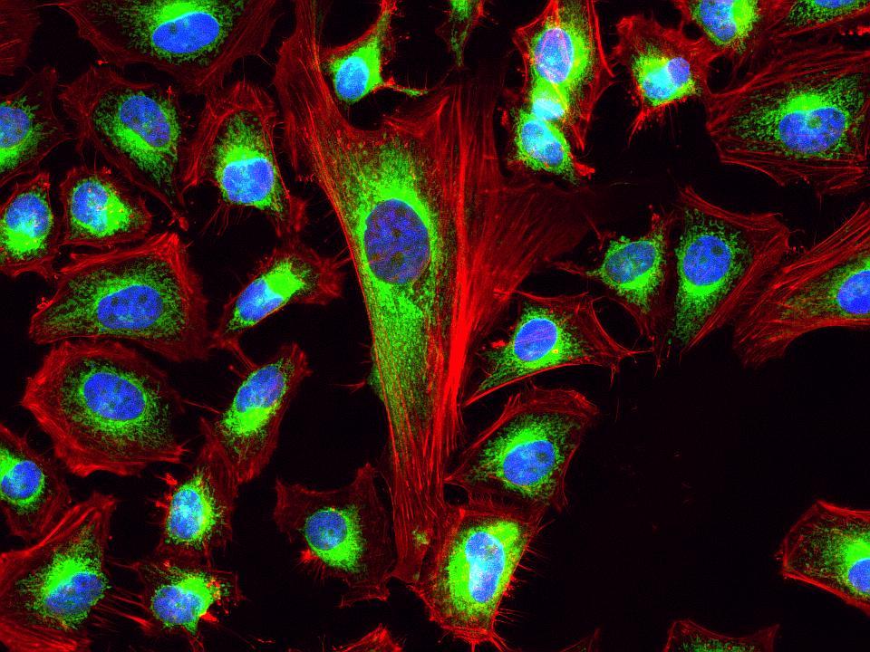 Fluorescence images of HeLa cells stained with Phalloidin-iFluor® 633 Conjugate using fluorescence microscope with a Cy5 filter set. Live cells were stained with mitochondria dye MitoLite™ Green (Cat#22666, Green) and imaged. After fixation in 4% formaldehyde, the cells were labeled with F-actin dye iFluor® 633-Phalloidin (Red) and counterstained with Nuclear Blue™ DCS1 (Cat#17548, Blue).