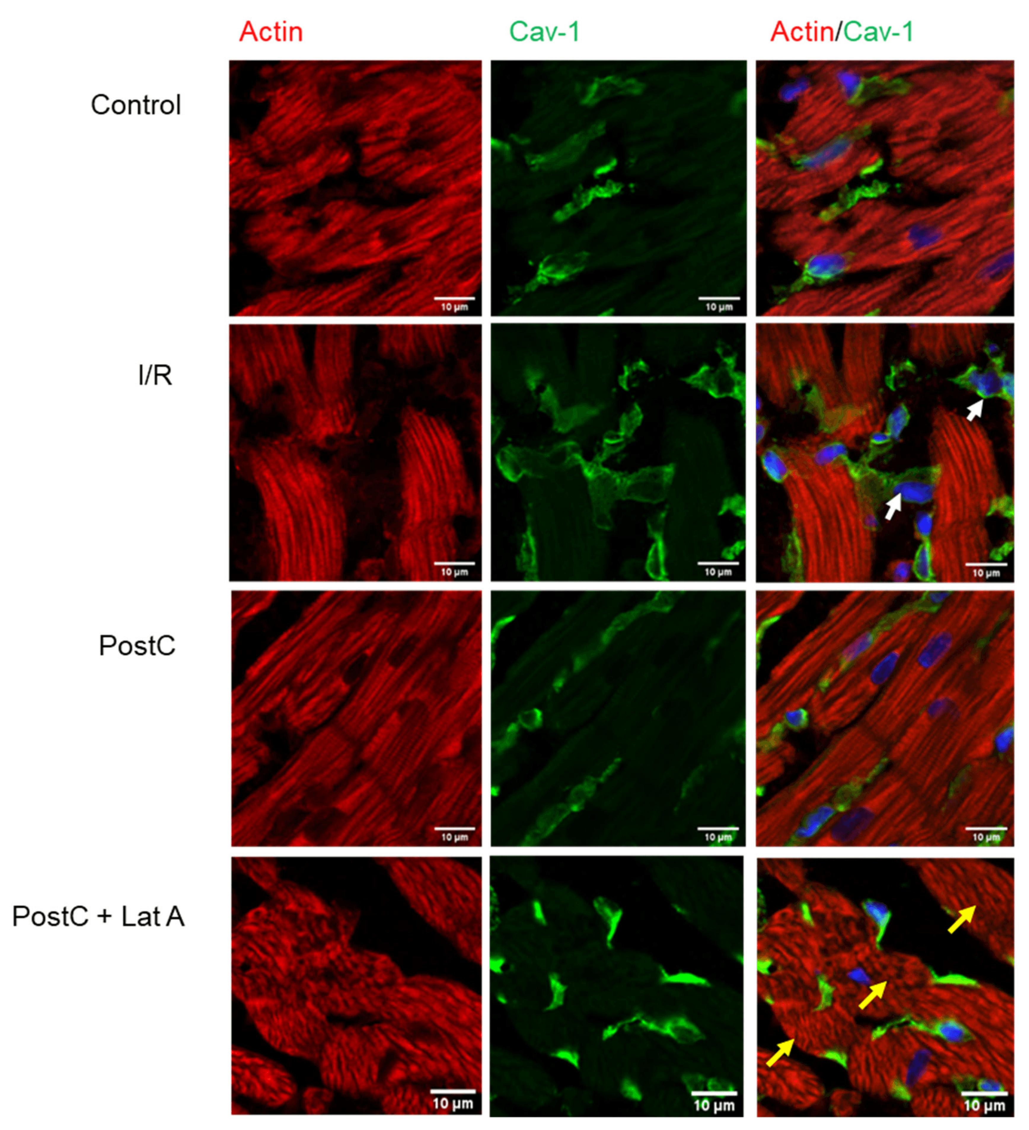 Co-localization of caveolin-1 and actin in post-conditioned hearts treated with latrunculin A. Representative confocal laser microscopy of the sections of frozen heart tissue after double-immunofluorescence staining of caveolin-1 (green) and actin (red). Cell nuclei were counterstained with DAPI. Source: <b>Actin-Cytoskeleton Drives Caveolae Signaling to Mitochondria during Postconditioning</b> by Correa <em>et. al.</em>, <em>Cells</em>. Feb. 2023.