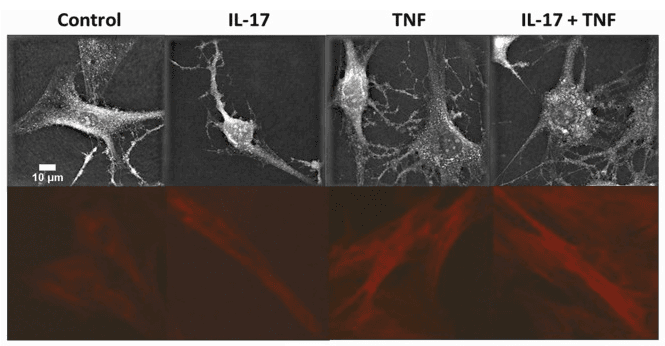 Cytokines induce intracellular component and cytoskeleton changes in RA synoviocytes. Holographic and tomographic microscopy images and phalloidin staining. Phalloidin-iFluor 647 was used for staining. Source: <b>Effects of pro-inflammatory cytokines and cell interactions on cell area and cytoskeleton of rheumatoid arthritis synoviocytes and immune cells</b> by Filali <em>et. al.</em>, <em>European Journal of Cell Biology</em>. March 2023