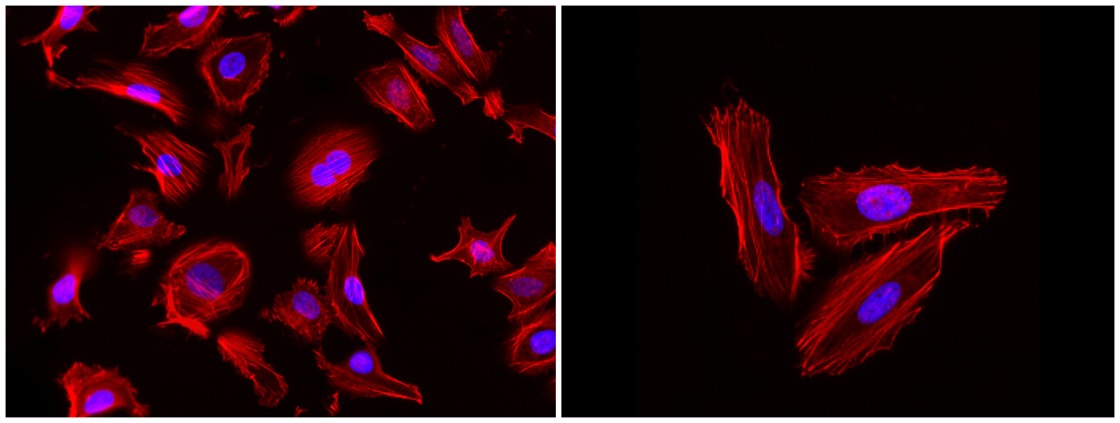 HeLa cells were fixed with 4% formaldehyde and subsequently stained with 0.25 µM Phalloidin-iFluor® 660 conjugate to label F-actin. Nuclei were counterstained with Hoechst 33342 (#17530) for 20 minutes at room temperature. Fluorescent imaging was performed using the Cy5 and DAPI channels, enabling precise visualization of F-actin localization and nuclear structures.
