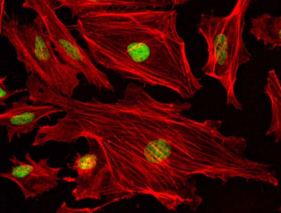 Fluorescence image of HeLa cells fixed with 4% formaldehyde then stained with Phalloidin-iFluor™ 680 Conjugate (Cat#23128, Red) and nuclei stain Nuclear Green™ DCS1 (Cat#17550, Green)