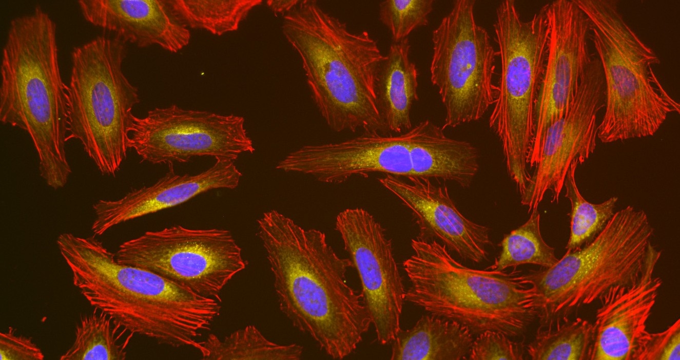 Fluorescence image of HeLa cells stained with Phalloidin-iFluor® 750 Conjugate using fluorescence microscope with a Cy7 filter set. The cells were fixed in 4% formaldehyde, permeabilised with 0.2% Triton X-100 followed by staining with Phalloidin-iFluor® 750 Conjugate (#23130), MitoLite™ Orange FX570 (#22676) and counter staining with Nuclear Blue™ DCS1 (#17548). The image was acquired with a fluorescence microscope using Cy7, Cy3-TRITC and DAPI filters, respectively.