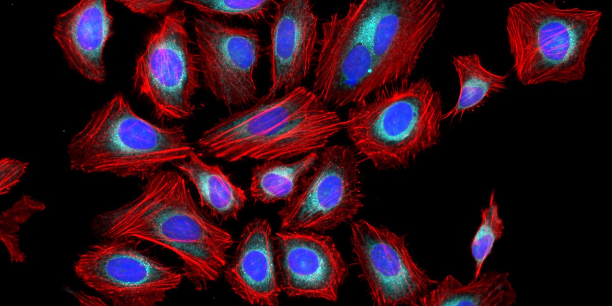 Fluorescence image of HeLa cells stained with Phalloidin-iFluor® 790 Conjugate using fluorescence microscope with a Cy7 filter set. The cells were fixed in 4% formaldehyde, permeabilised with 0.2% Triton X-100 followed by staining with Phalloidin-iFluor® 790 Conjugate (#23131), MitoLite™ Red FX600 (#22677) and counter staining with Nuclear Blue™ DCS1 (#17548). The image was acquired with a fluorescence microscope using Cy7, Cy3-TRITC and DAPI filters, respectively.